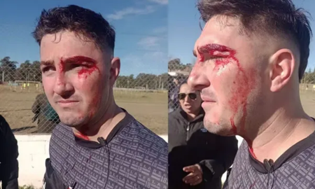 Un técnico de fútbol fue detenido tras agredir al árbitro durante un partido de la Liga Venadense. Un técnico de fútbol fue detenido tras agredir al árbitro durante un partido de la Liga Venadense.