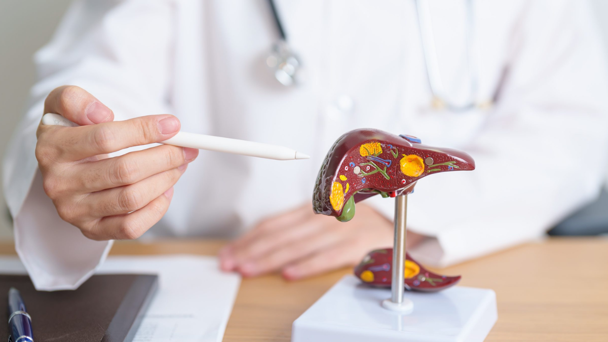 La detección temprana mediante ecografía permite identificar la esteatosis hepática metabólica antes de que se presenten complicaciones graves.