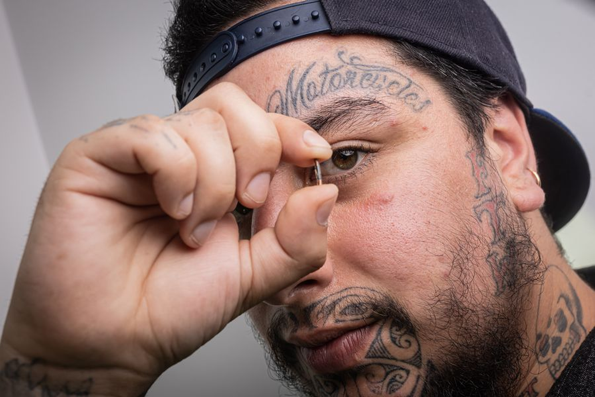 El implante que permitiría pagar cuentas con un chip bajo la piel