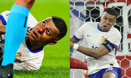 Preocupación por una posible fractura de Kylian Mbappé en el debut de Francia en la Eurocopa: No está bien Preocupación por una posible fractura de Kylian Mbappé en el debut de Francia en la Eurocopa: No está bien