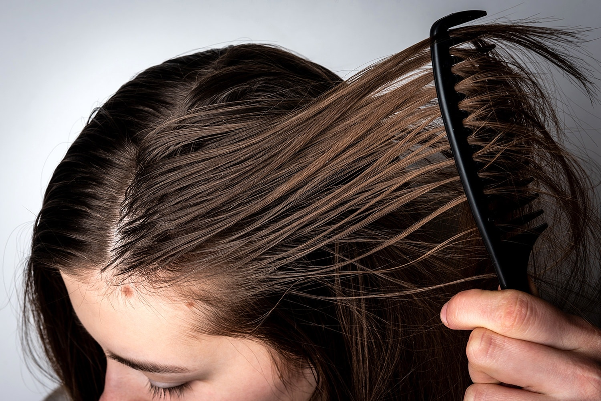 El exceso de sebo es uno de los problemas más comunes en el cabello de adolescentes.