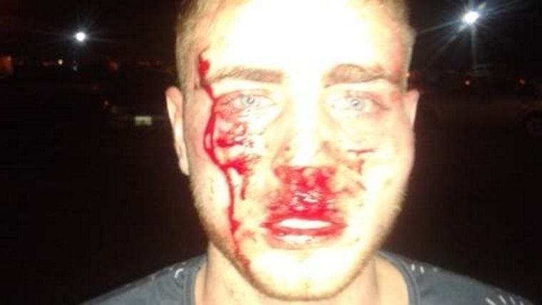 Denuncia feroz golpiza de patovicas en un boliche