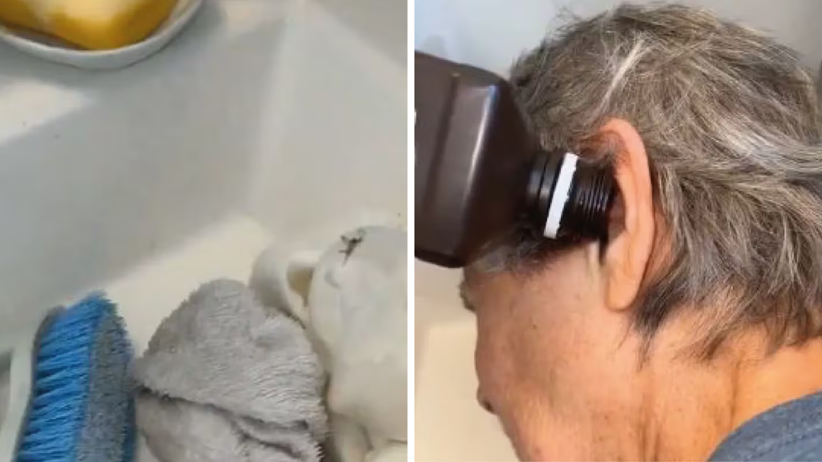 Fue al médico porque le dolía el oído y lo que le encontraron dejó a todos impactado.