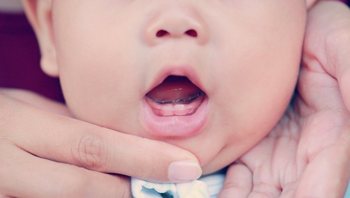 Nueva moda con polémica: cortar el frenillo de la lengua de los bebés