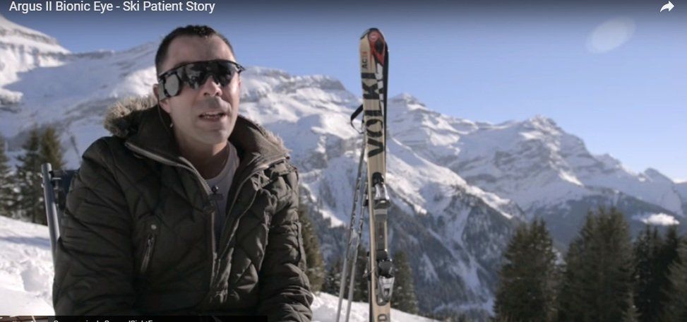 Llega el ojo biónico que devuelve parte de visión en caso de ceguera congénita