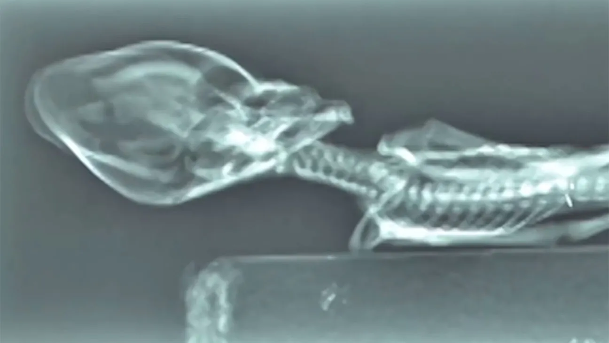 Captura del documental Captura del documental