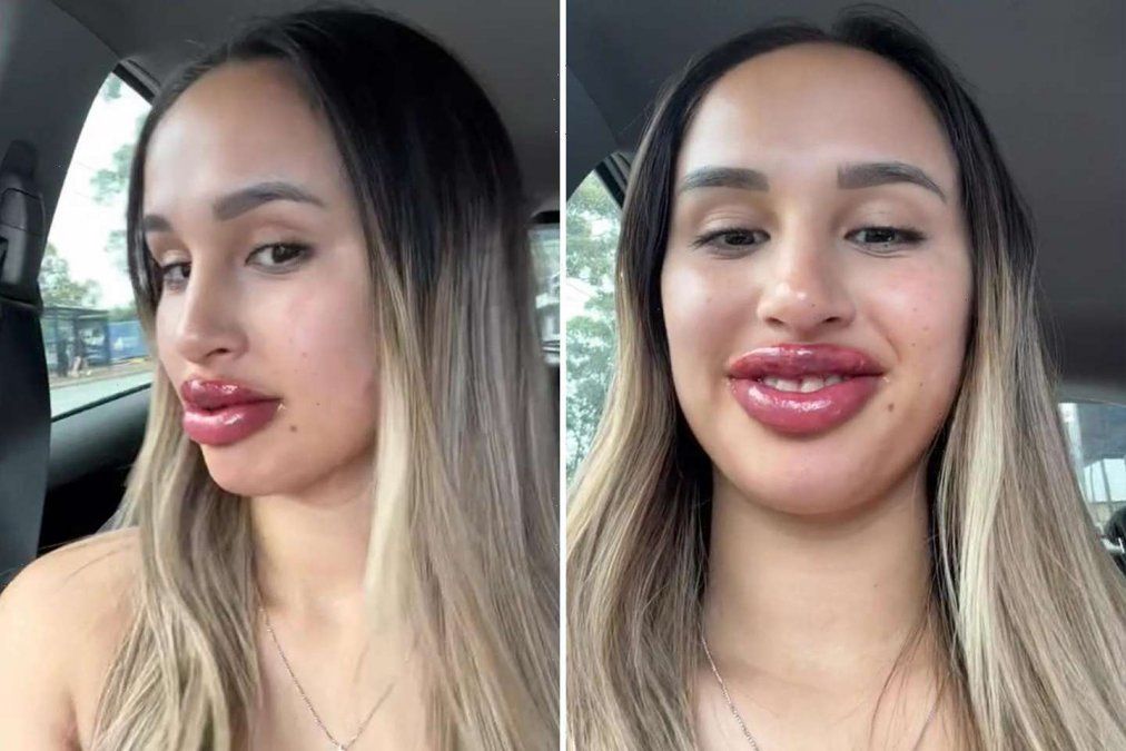 Recibió un canje para tatuarse los labios