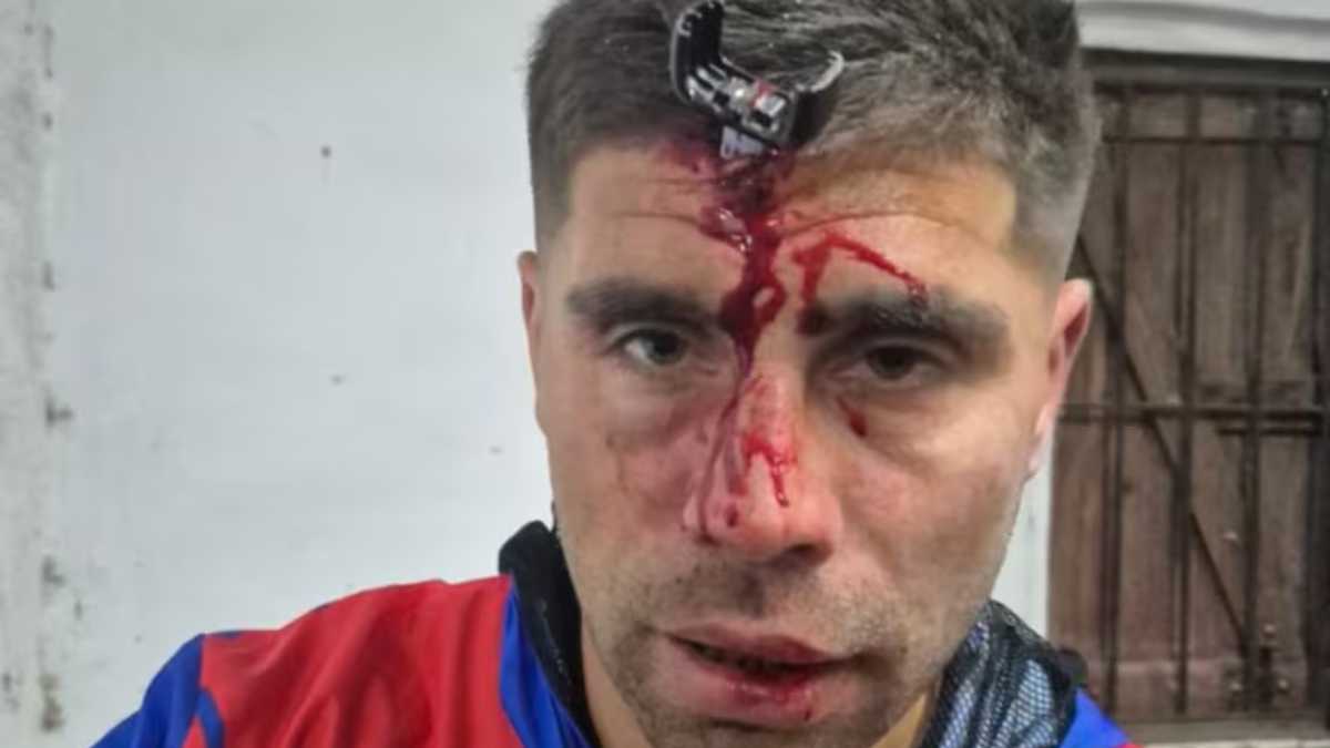 Ataque a Jonathan Smith durante un partido femenino en Berazategui sufrió una fractura de cráneo. Ataque a Jonathan Smith durante un partido femenino en Berazategui sufrió una fractura de cráneo.
