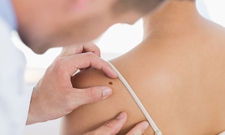 Habrá consultas dermatológicas y chequeos gratuitos en hospitales de Rosario, Santa Fe y Reconquista, entre el 16 y el 19 de noviembre. Detectado y tratado tempranamente, el cáncer de piel tiene 95% de posibilidades de cura. Habrá consultas dermatológicas y chequeos gratuitos en hospitales de Rosario, Santa Fe y Reconquista, entre el 16 y el 19 de noviembre. Detectado y tratado tempranamente, el cáncer de piel tiene 95% de posibilidades de cura.
