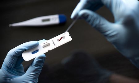 Un test serológico mide anticuerpos en suero (sangre). Un test serológico mide anticuerpos en suero (sangre).