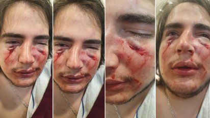 Imputaron a dos rugbiers por la golpiza al adolescente en Córdoba