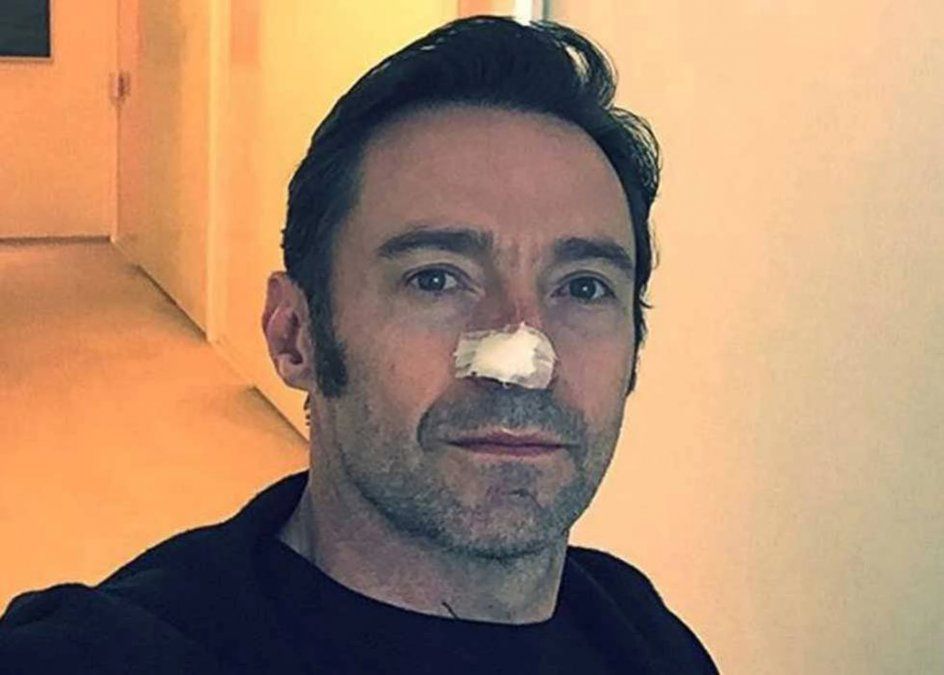 Hugh Jackman.