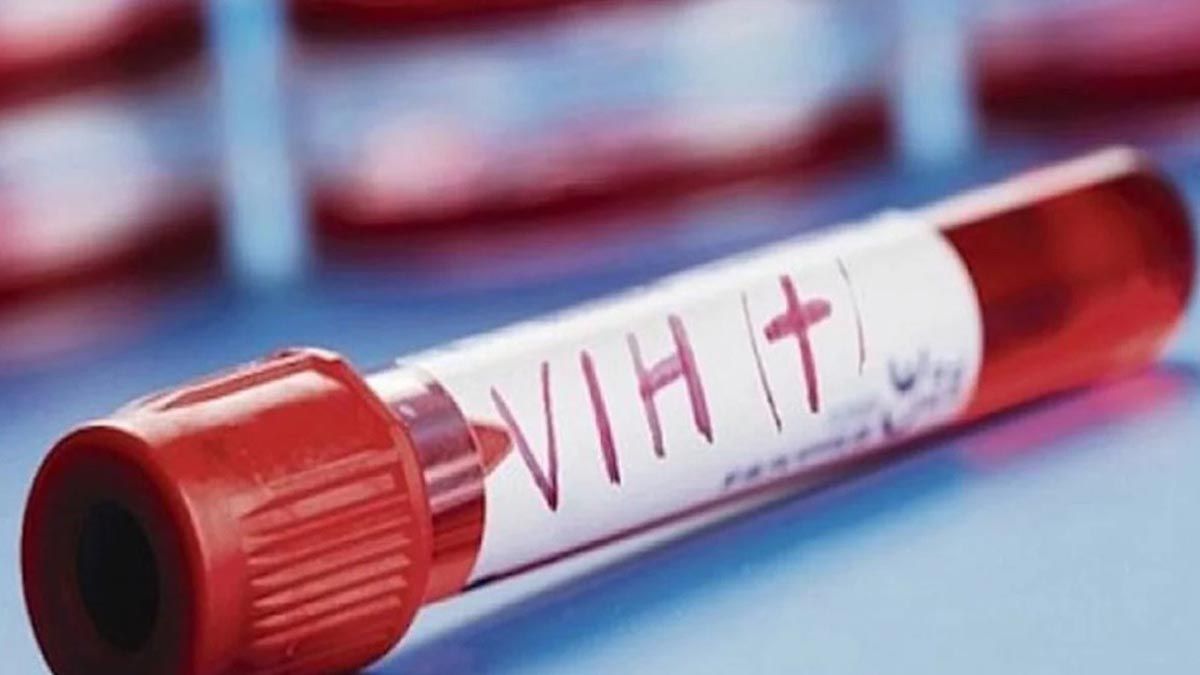 Se cumple 40 años desde la aparición de los primeros casos de VIH en el mundo.