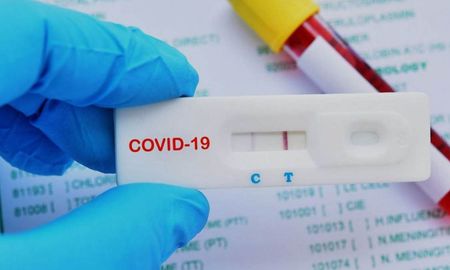 Aguardan definiciones acerca de si los autotest van a ser hechos por cada persona en su casa o en farmacias, para que puedan quedar asentados los resultados. Aguardan definiciones acerca de si los autotest van a ser hechos por cada persona en su casa o en farmacias, para que puedan quedar asentados los resultados.