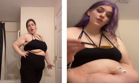 La joven que muestra el exceso de piel que le quedó tras adelgazar 50 kilos La joven que muestra el exceso de piel que le quedó tras adelgazar 50 kilos