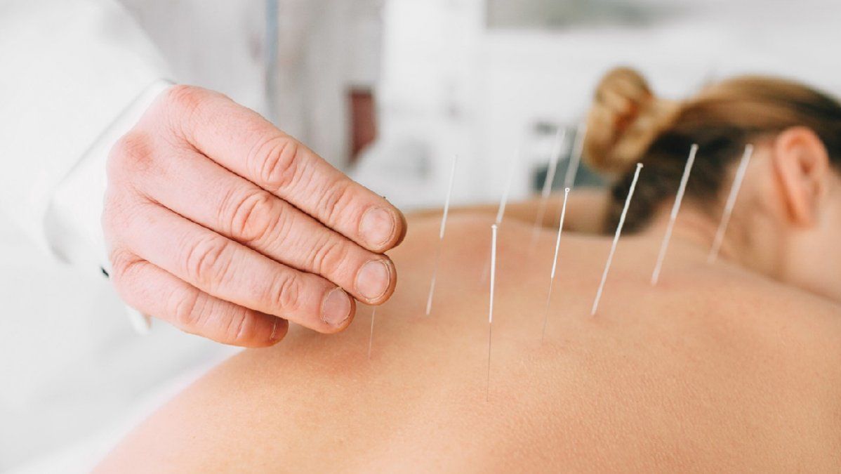 La acupuntura es una técnica muy utilizada no solo para tratar el dolor, sino para disminuir el estrés, mejorar la calidad de vida y el bienestar de quienes la practican.