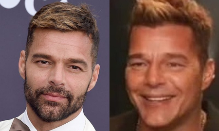 Qué le pasó en la cara a Ricky Martin: el artista sorprendió al posar con un rostro totalmente cambiado Qué le pasó en la cara a Ricky Martin: el artista sorprendió al posar con un rostro totalmente cambiado