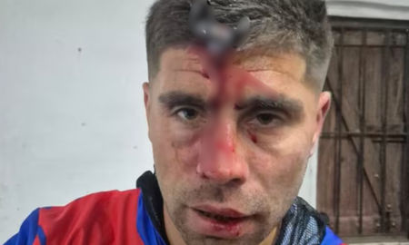 Ataque a Jonathan Smith durante un partido femenino en Berazategui sufrió una fractura de cráneo. Ataque a Jonathan Smith durante un partido femenino en Berazategui sufrió una fractura de cráneo.