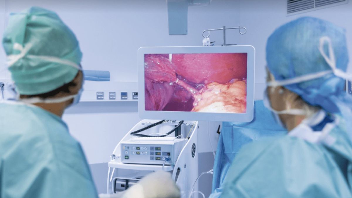 La endoscopia es uno de los estudios de diagn&oacute;stico para detectar patolog&iacute;as en el colon.