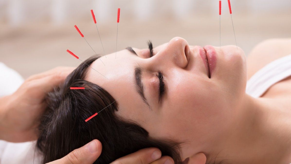 Esta técnica China consiste en la inserción de agujas muy finas en la piel en puntos estratégicos del cuerpo para equilibrar el flujo de energía o fuerza vital.