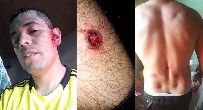 El hermano de Rocío Oliva resultó herido tras un motín en la cárcel donde está alojado.