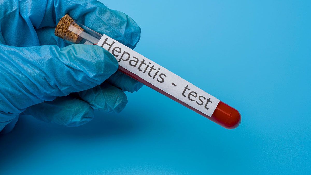 Recomiendan realizarse el test de hepatitis, enfermedad que afecta a 300.000 personas en el país