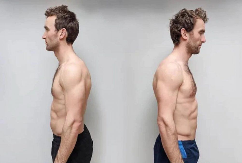 Dieta vegana vs dieta carnívora: el experimento definitivo de dos gemelos