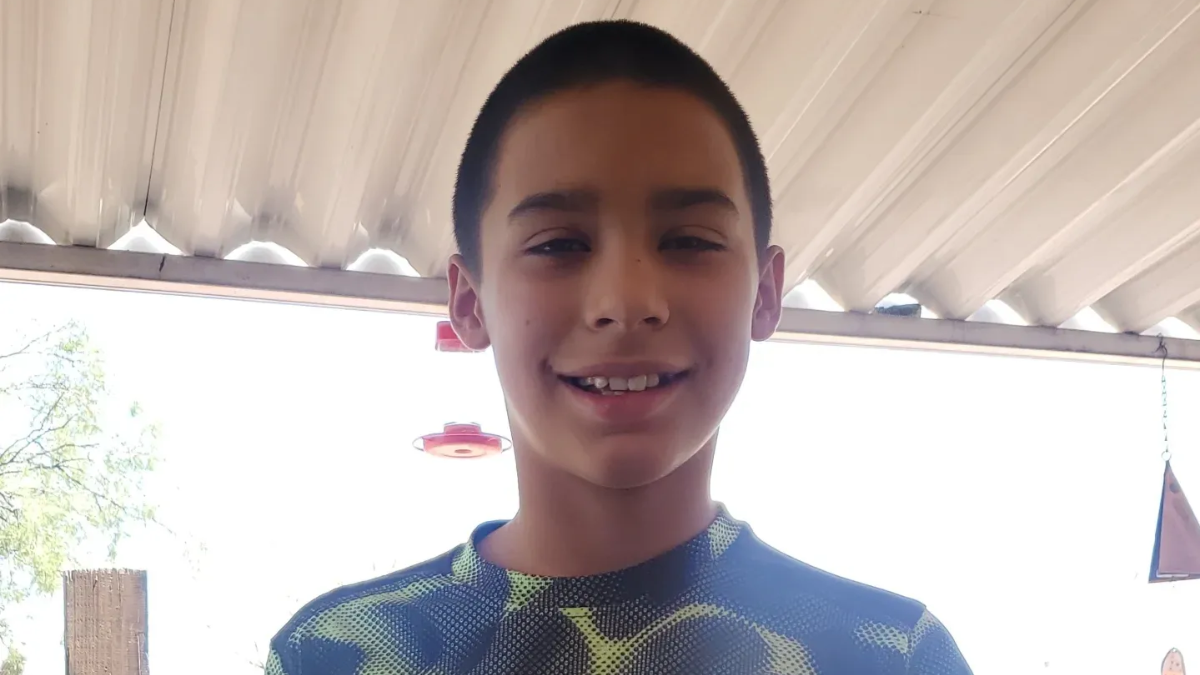 Un nene de 12 años intentó hacer un desafío viral de TikTok y se quemó la mitad del cuerpo