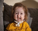 la historia de isla, la nena de dos anos que parece de ochenta por la enfermedad de benjamin button la historia de isla, la nena de dos anos que parece de ochenta por la enfermedad de benjamin button