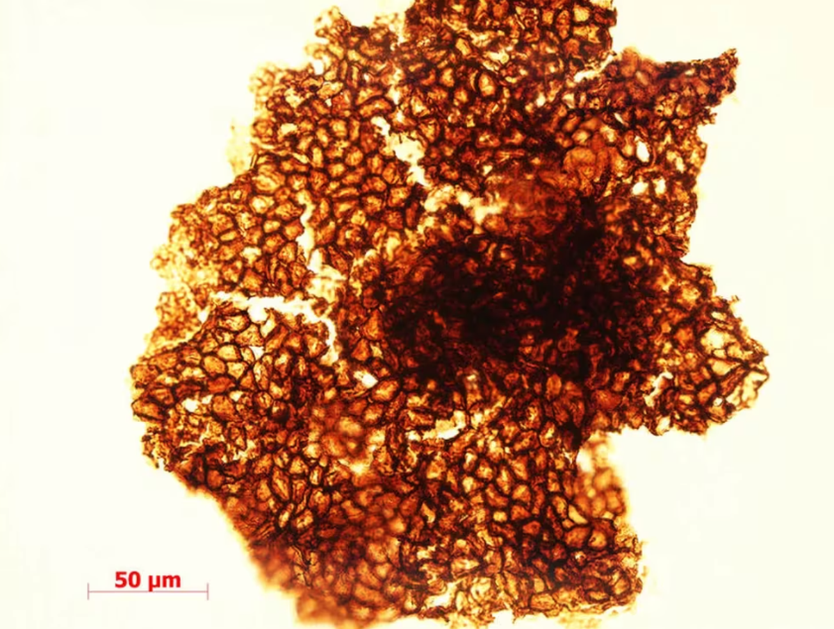 Ejemplar del organismo multicelular observado por microscopio. Ejemplar del organismo multicelular observado por microscopio. 