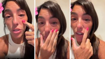 Catalina Gorostidi padece un problema de salud y alarmó a sus seguidores: Cada vez peor