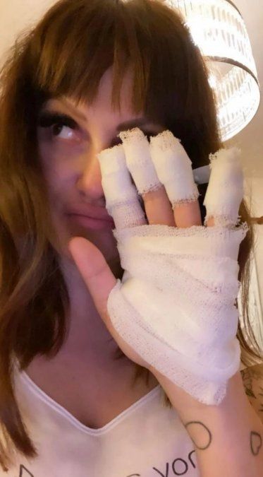 La foto de Connie Ansaldi tras sufrir graves quemaduras