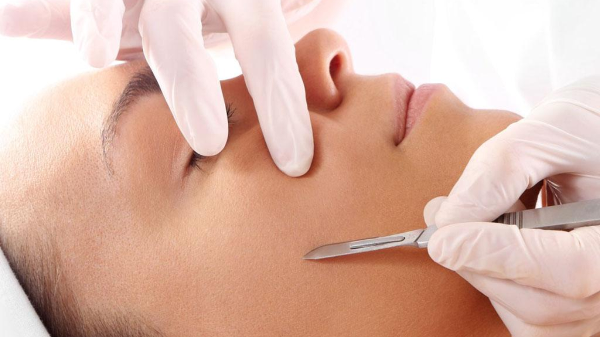 Los beneficios y riesgos del Dermaplaning