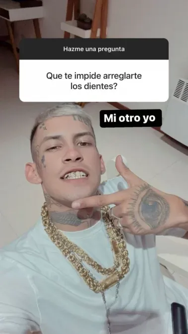 L-Gante no se arreglará la dentadura.