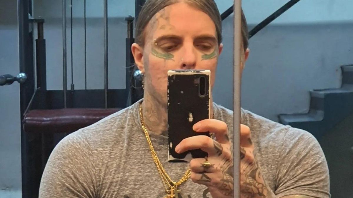 Pera fue operado y los médicos aguardan su evolución. Pera fue operado y los médicos aguardan su evolución.