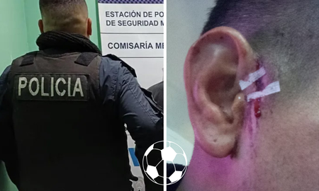 Futbolista atacado con un cuchillo fue a hacer la denuncia, pero no se la tomaron por un hecho insólito Futbolista atacado con un cuchillo fue a hacer la denuncia, pero no se la tomaron por un hecho insólito