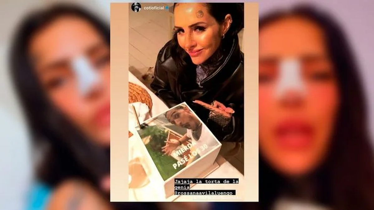 Cande Tinelli mostr&oacute; c&oacute;mo le qued&oacute; la nariz.
