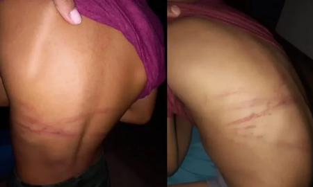 Horror en Misiones: una mujer castigó a palazos a su hijo de 7 años y fue denunciada Horror en Misiones: una mujer castigó a palazos a su hijo de 7 años y fue denunciada