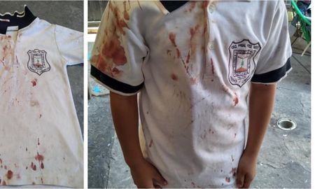La “chomba ensangrentada”: la terrible foto que publicó la mamá de un nene que sufre bullying