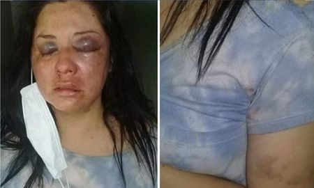 Una mujer se escapó del hospital por miedo a que su marido la mate Una mujer se escapó del hospital por miedo a que su marido la mate