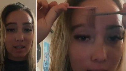 Se hizo un trasplante de pelo en las cejas y ahora tiene que recortarlas.