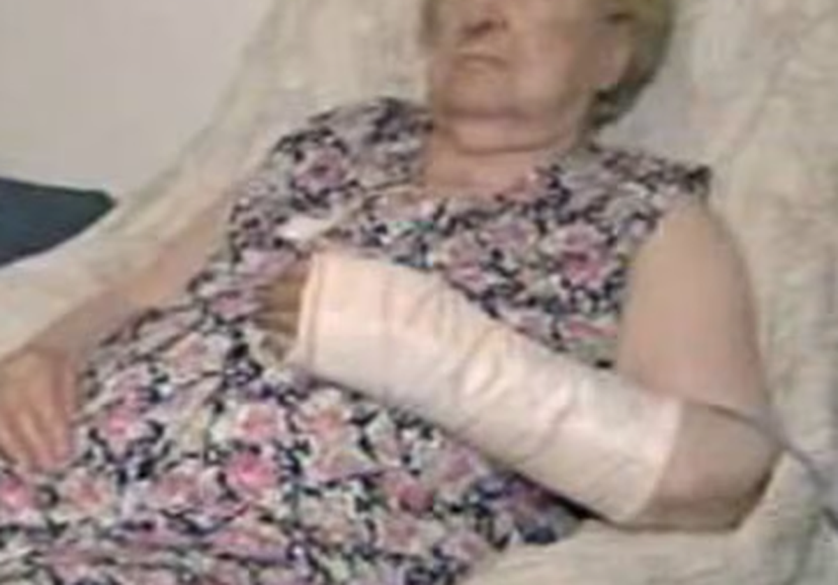 La paciente presentaba una hinchazón notable, evidentes signos de dolor y un moretón destacado. La paciente presentaba una hinchazón notable, evidentes signos de dolor y un moretón destacado.