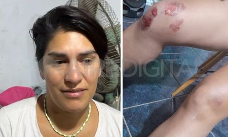 Asalto en el barrio Coronel Dorrego: la mujer fue emboscada por dos delincuentes Asalto en el barrio Coronel Dorrego: la mujer fue emboscada por dos delincuentes
