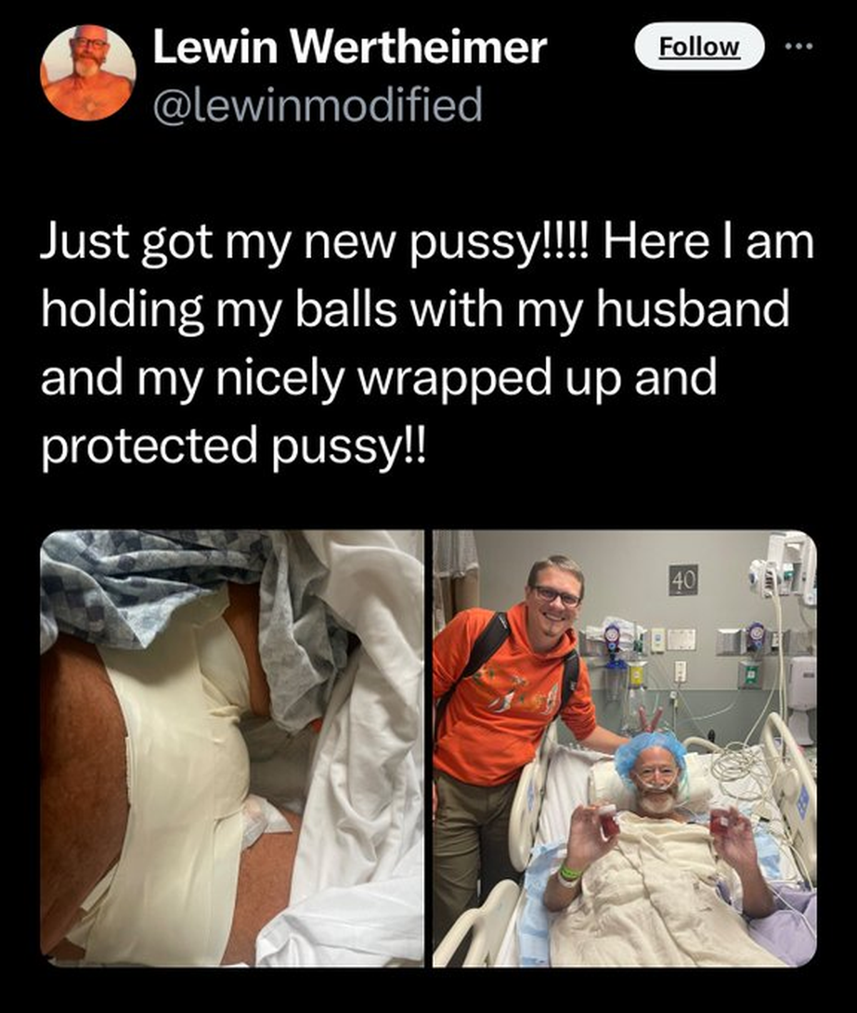 Lewin Wertheimer compartió que se extirpó los genitales y se volvió viral. Lewin Wertheimer compartió que se extirpó los genitales y se volvió viral.