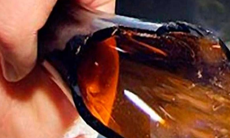 Dio un botellazo en el rostro a su pareja para sacarle dinero Dio un botellazo en el rostro a su pareja para sacarle dinero