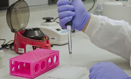 La OMS informó que las muertes por coronavirus aumentaron 35% a nivel mundial en el último mes. La OMS informó que las muertes por coronavirus aumentaron 35% a nivel mundial en el último mes.