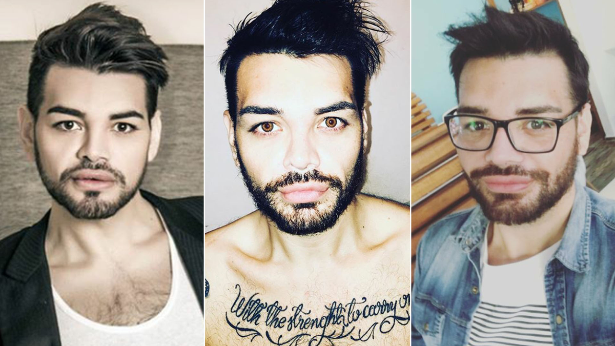 Bajó más de 90 kilos en el programa y llegó hasta la prestigiosa revista People. En su afán por ser como el cantante, perdió la cuenta de la cantidad de intervenciones estéticas a las que se sometió.