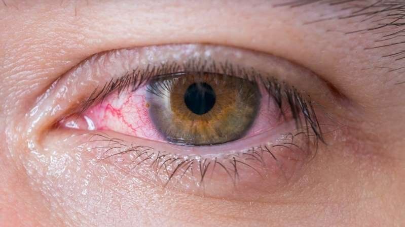 ojo.jpg