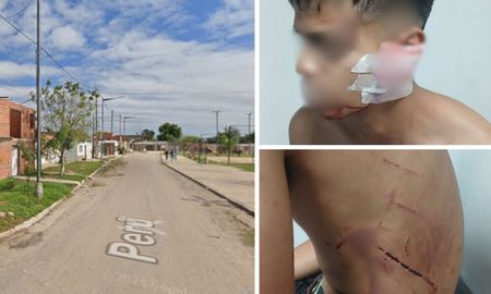 Barrio Barranquitas: tres heridos en una gresca Barrio Barranquitas: tres heridos en una gresca