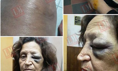 Una de las personas golpeadas. Crédito: Luciano Mascaldi Una de las personas golpeadas. Crédito: Luciano Mascaldi